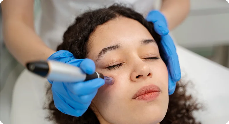SkinPen Microneedling