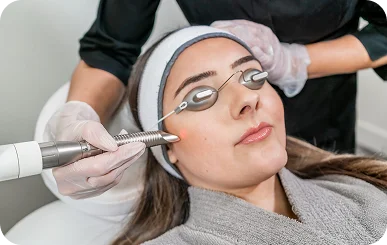 Laser Skin Resurfacing
