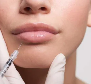 Dermal Fillers